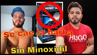 Minoxidil si eres lampiño Que pasa si ya no usas minoxidil permanece la barba?