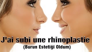 J'ai subi une rhinoplastie