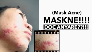 MASKNE Skin Journey|First time to go to the Derma in Dubai