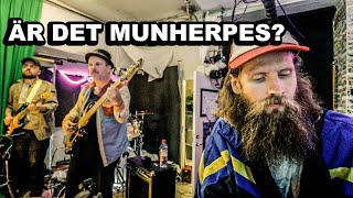 Munherpes