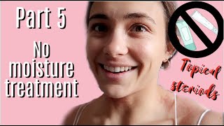 NO MOISTURE TREATMENT PART V | TOPICAL STEROID WITHDRAWAL | SUCCESS