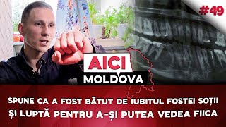 Afirmă că a fost bătut de iubitul fostei soții și luptă pentru a-și vedea copilul. AICI MOLDOVA #49