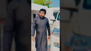 Khizar Omer Before 😥 And After 😍 Haie Mashallah ❤️#youtubeshort #khizaromer #khizaromerextra #short