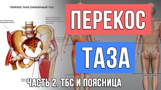 Перекос таза. Программа занятий. Часть 2 из 5