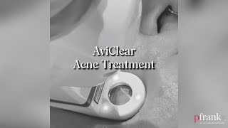 Breakthrough Acne Treatment With AviClear