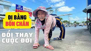 Người mẹ đi bằng 4 chân cõng con trên lưng đổi thay cuộc đời để nuôi con I Phong Bụi