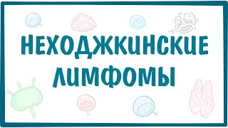 Неходжкинские лимфомы — причины, симптомы, патогенез, диагностика, лечение