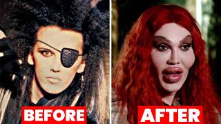 20 Actors Plastic Surgery Disasters