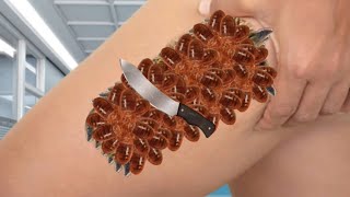 Acne Removal ASMR - Satisfying AnimationThe ASMR Acne Treatment You've Been Waiting For