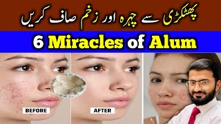 6 Amazing Benefits of Alum | Clean your face by Fitkri in Urdu/Hindi