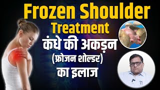 Frozen Shoulder - Symptoms and Causes | क्या है फ्रोजन शोल्डर, इसके कारण एवं लक्षण