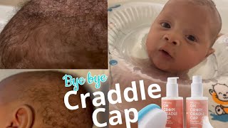 Fridababy Oh Crap! Cradle Cap & FlakeFixer w/ #Otteroo Float