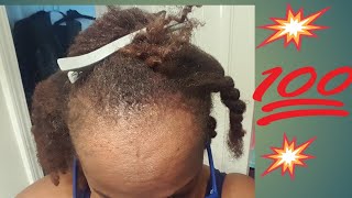 Hair Update & Dealing w/ Emotional Pain after Suicide