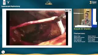 Laparoscopic nephrectomy                                          step by step