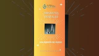 IMPLANTES DENTALES SIN INJERTO