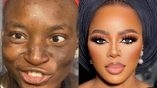 MUST WATCH 😳 👆 BRIDAL GELE AND MAKEUP TRANSFORMATION 👌 👆 CIRURGIA PLASTICA 💉 💣