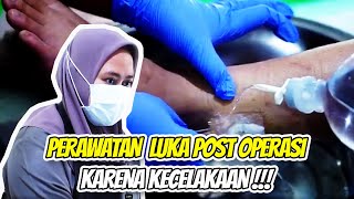 PERAWATAN LUKA POST OPERASI KARENA KECELAKAAN ❗PERAWATAN LUKA BY PEDIS CARE