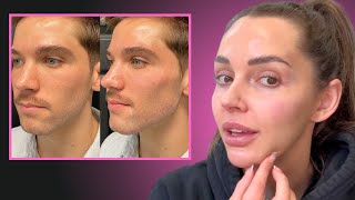 Masculine vs Feminine Facial Contouring