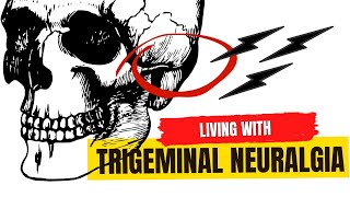 living with "the worst pain in the world" (Trigeminal Neuralgia) | JESSICA DOBBS