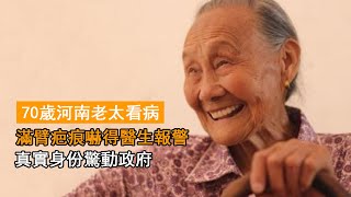 70歲河南老太看病， 滿臂疤痕嚇得醫生報警，真實身份驚動政府