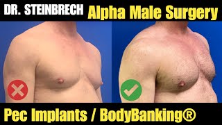 Pec Implants with BodyBanking® | Alpha Male Plastic Surgery by Dr. Steinbrech