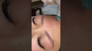 HydraFacial Treatment