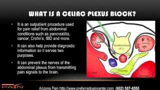 Celiac Plexus Block for Abdominal Pain Explained (602) 507-6550