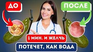 СМОТРИТЕ! ТАКОЕ не расскажут в больнице! Признаки застоя желчи! Работать с желчью нужно всем!