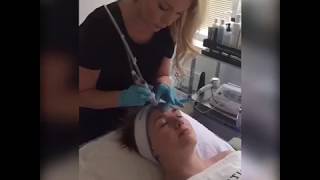 Experience the HYDRAFACIAL at NOVA Plastic Surgery