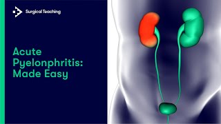 Acute Pyelonphritis | All you need to know