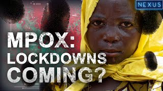 Mpox Outbreak: Return of Lockdown?