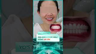 Bọc 28 răng sứ khắc phục tình trạng răng xỉn màu #nhakhoasaigon #yosdental #nhakhoabinhduong