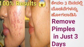 🔥 Remove Pimples and Acne Scars By Homemade Face Pack In Kannada