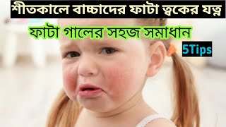 শীতে বাচ্চার ত্বকের যত্ন। শীতকালে বাচ্চার ত্বক কিভাবে রাখবেন। গাল ফাটা সমস্যার সহজ সমাধান.