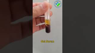 Serum Extraction | Serum | serum separating tube | Centrifugation | serum separatation | Gel tube