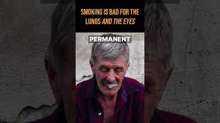 #shorts Warning: Smoking Damages Eye Health (2024)