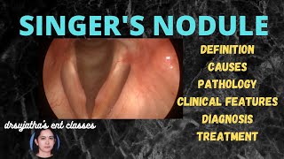 147.Vocal Nodules  # vocal nodule lecture #voicestatus #anatomylectures