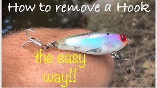 HOW TO REMOVE A HOOK FROM YOUR ARM!!