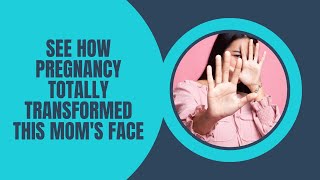 See How Pregnancy Totally Transformed This Mom's Face