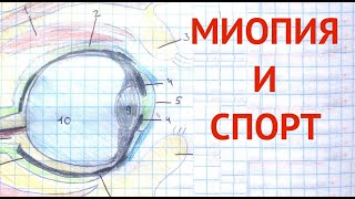 Миопия и спорт. Какие ограничения должны быть в спорте при близорукости. Глеб Арсланов