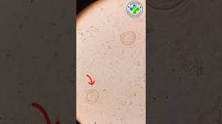 Parasitology | H Nana | hymenolepis nana under microscope | Tapeworm |stool examination | H Nana ova