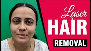 Best laser hair Removal | Testimonial | Sakhiya skin Clinic Review | Permanent laser hair removal