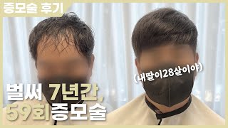 10살 어려지고, 머리숱 많아지는 가장 빠른 방법 [헤어증모술, 블랭크유, 남자 붙임머리]