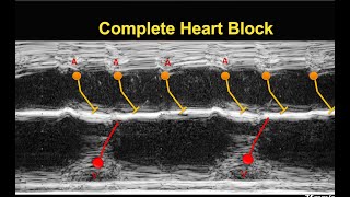 A Simplified Guide to diagnose Fetal Arrhythmia