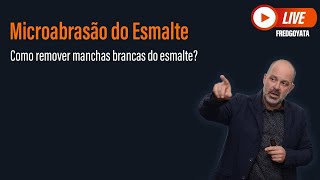 Microabrasão do Esmalte - Como Remover Manchas Brancas do Esmalte?