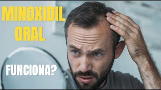 Minoxidil oral é eficaz?