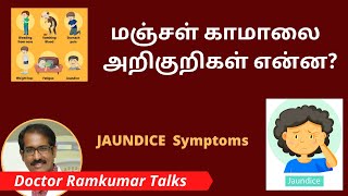 Symptoms of Jaundice in Tamil / மஞ்சள் காமாலை இருந்தால் அறிகுறிகள் என்ன, எப்படி இருக்கலாம் ? Dr Ram