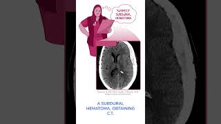 Diagnostics on Demand: Subdural hematoma