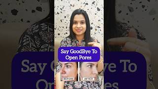 Say Goodbye to Open Pores #shorts #shortsvideo #short #shortvideo #youtubeshorts #trending #viral