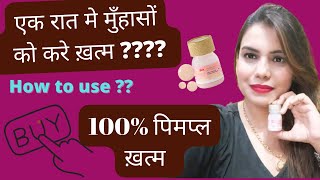 एक रात में पिंपल कैसे खत्म करें? How do you get rid of pimples instantly? 100% Remove Pimple , Scars